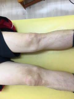 行徳 痺れ 改善事例